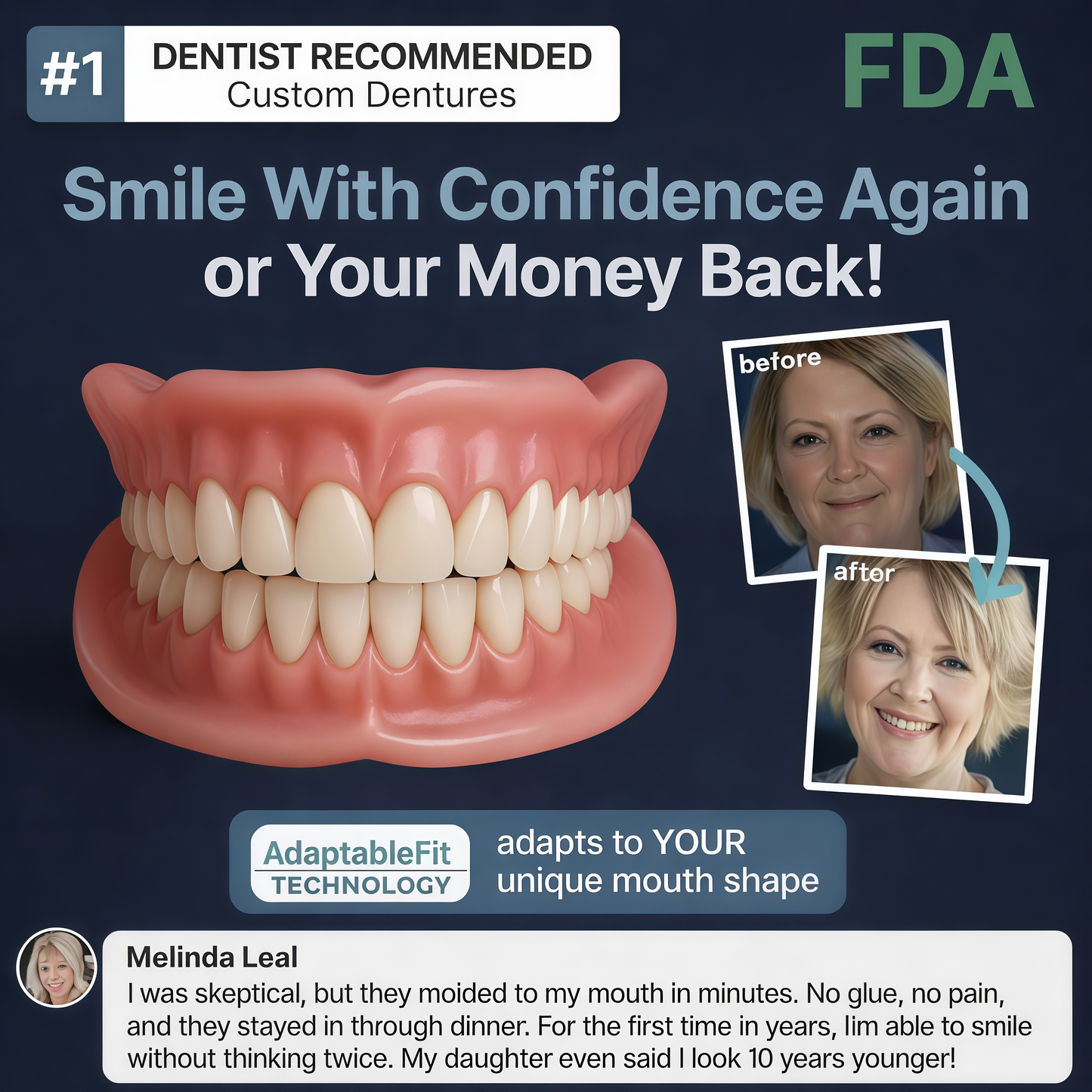🔥Shinneey™ Custom-Fit Functional Dentures — Made in the USA, FDA Certified, Up to 70% OFF for a More Confident Smile!