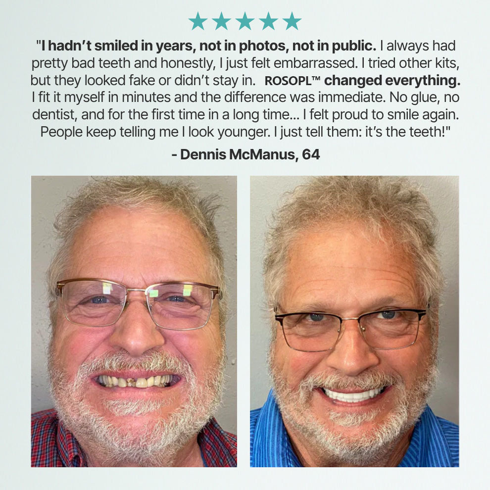 🌎Ends Today: 70% OFF! Shinneey™ Custom-Fit Full Functional Dentures Make you more confident