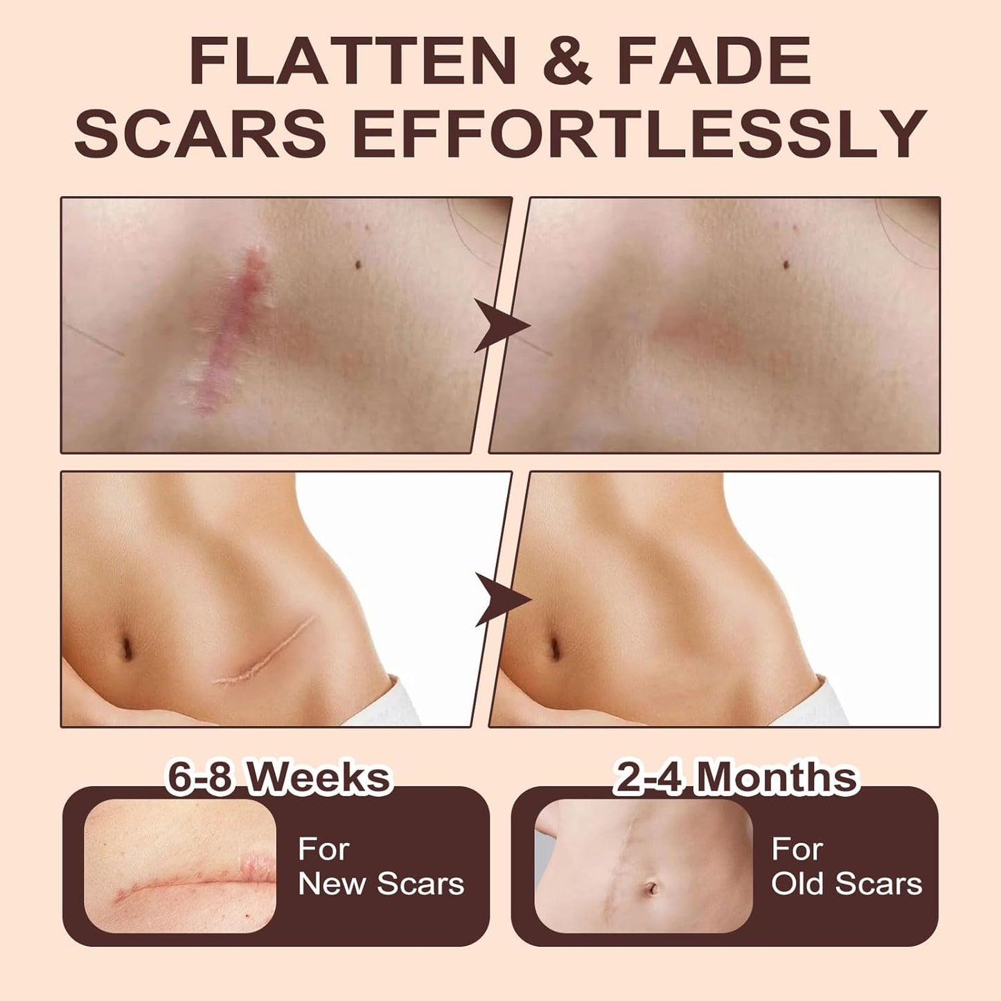 Shinneey™ Silicon Scar Stick Limited Time 70%OFF Buy 3 Get 3 Free 🔥LAST DAY⏰