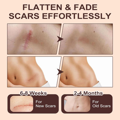 Shinneey™ Silicon Scar Stick Limited Time 70%OFF Buy 3 Get 3 Free 🔥LAST DAY⏰