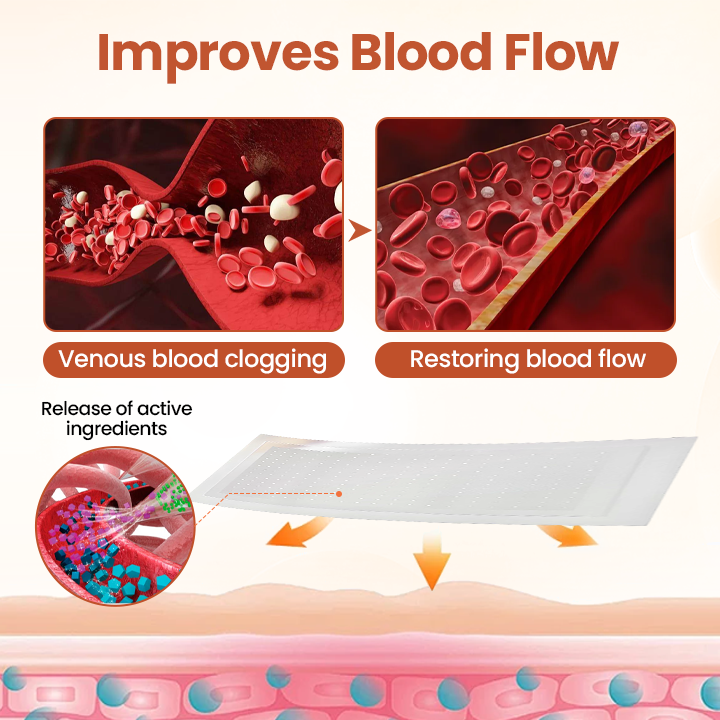Tired of Aching, Bulging Varicose Veins? Get Targeted Relief in Just 7 Days with These Patches!