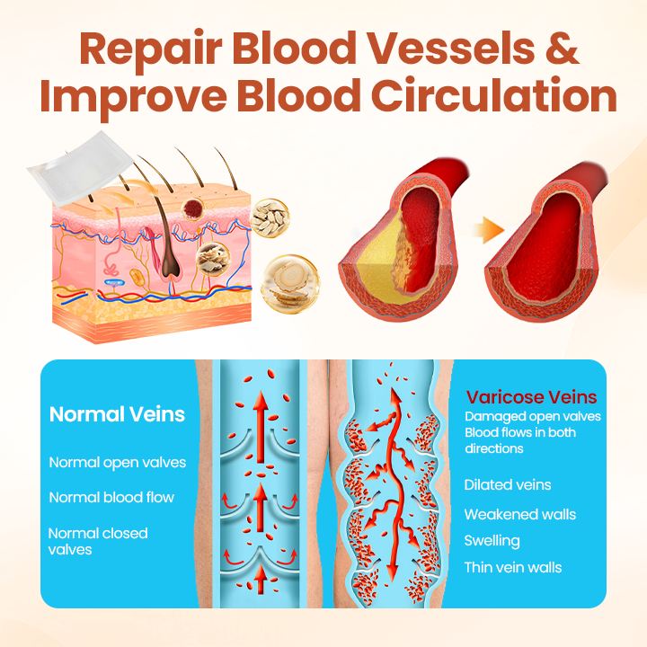 Tired of Aching, Bulging Varicose Veins? Get Targeted Relief in Just 7 Days with These Patches!