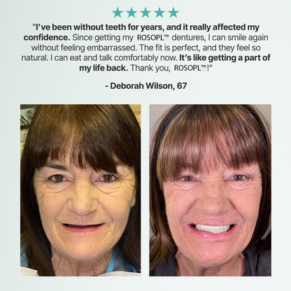 🌎Ends Today: 70% OFF! Shinneey™ Custom-Fit Full Functional Dentures Make you more confident