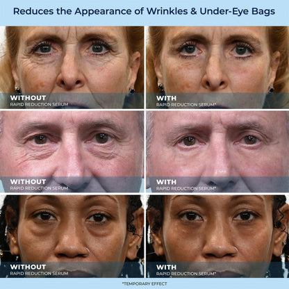 🔥Last Day Promotion 70% OFF Shinneey™ Savior for Eye Bags