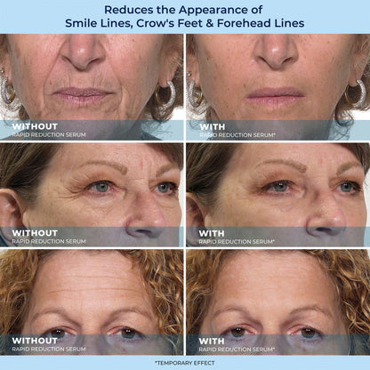 🔥Last Day Promotion 70% OFF Shinneey™ Savior for Eye Bags
